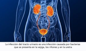 Infección Urinaria durante el Embarazo – Infogen