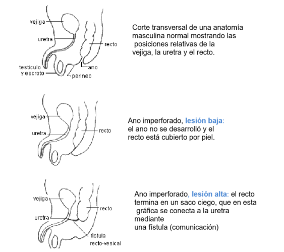 Ano imperforado – Infogen